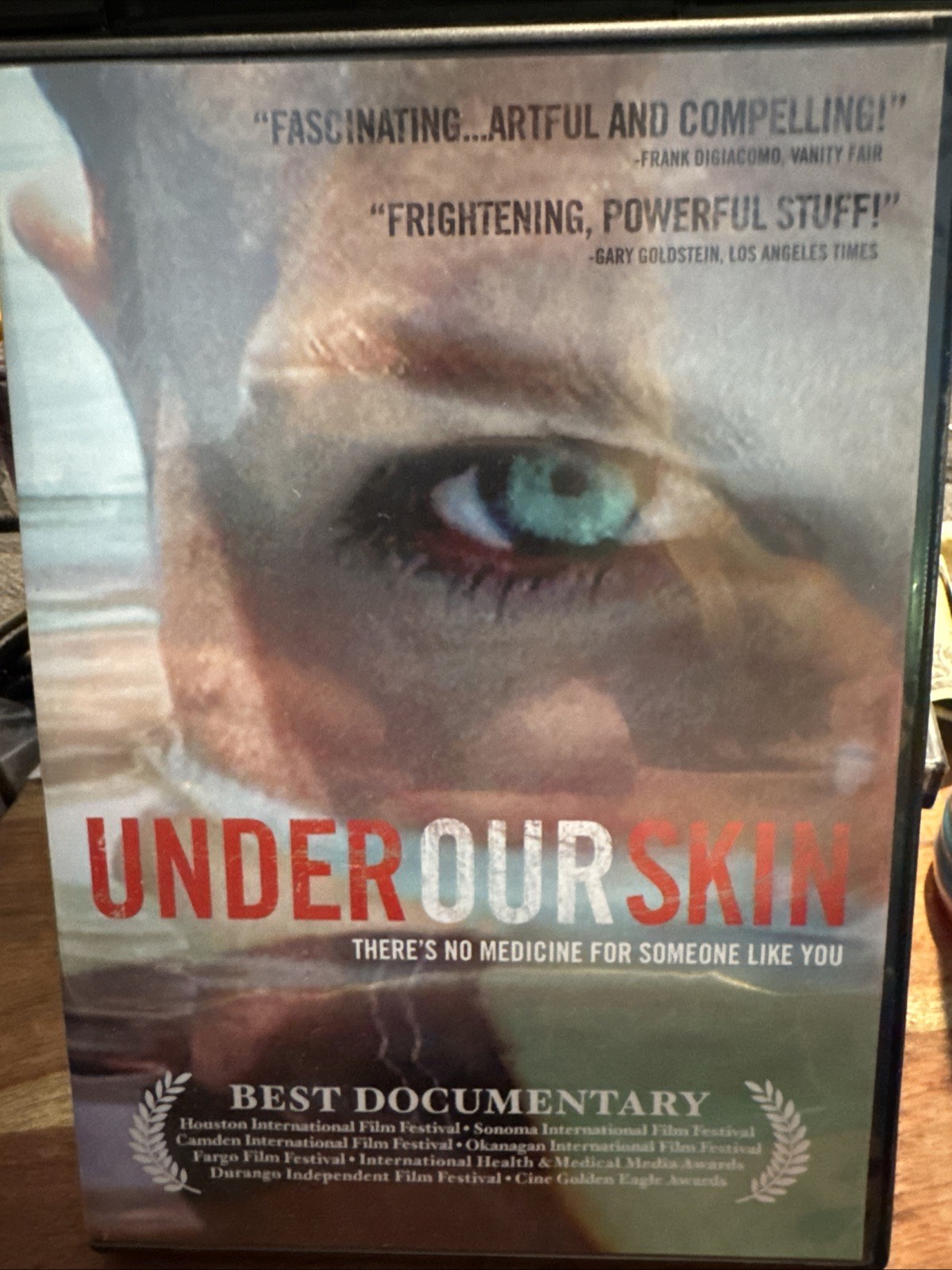Under Our Skin: A Health Care Nightmare Lyme Disease Documentary (DVD 2009) EUC