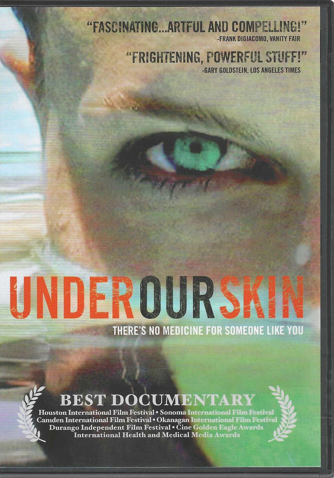 Under Our Skin (2008) – documentary – like new DVD