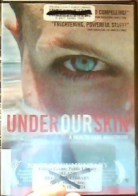 Under Our Skin