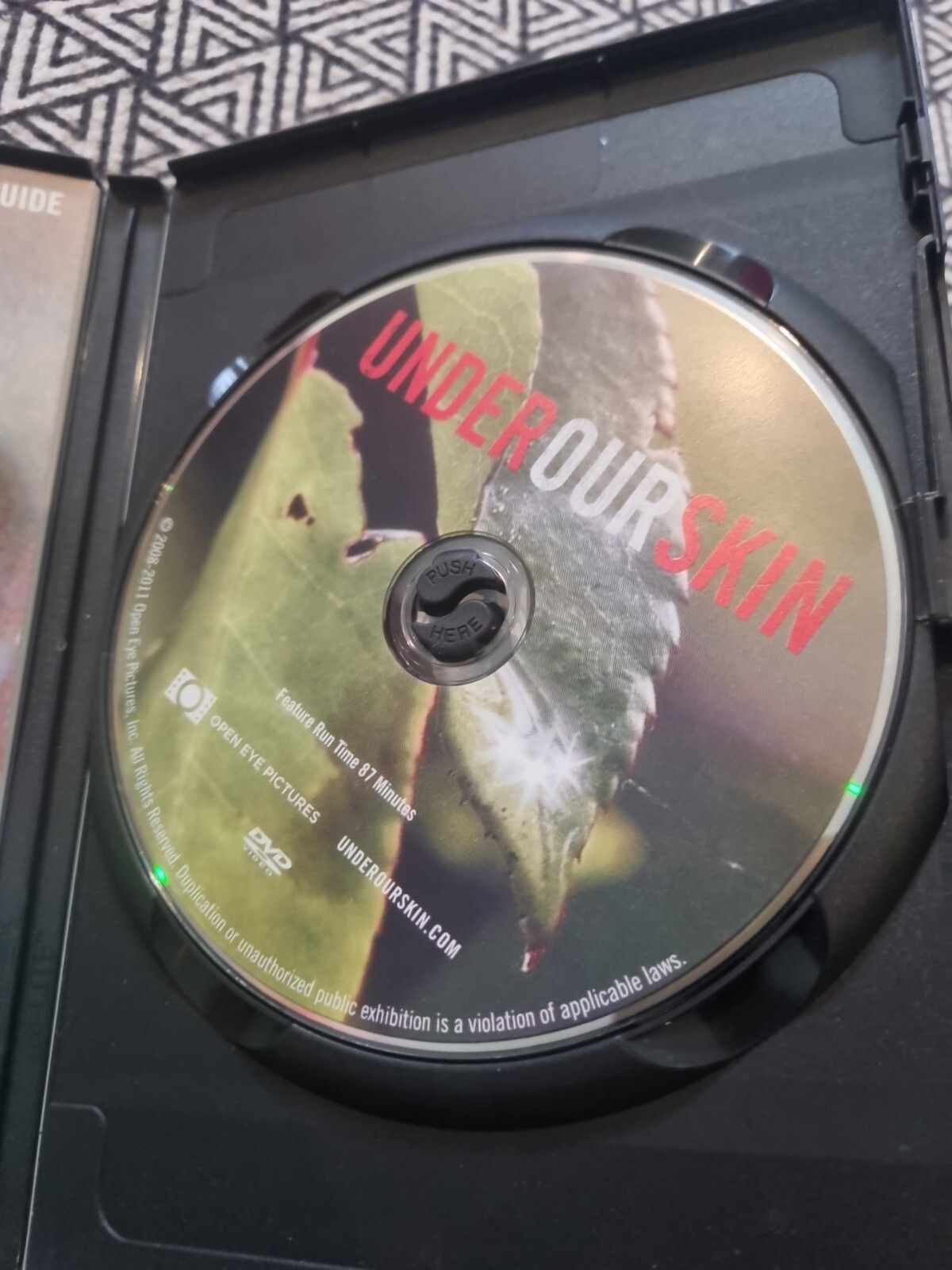 DVD Under Our Skin – A Health Care Nightmare * FREE POSTAGE * D1