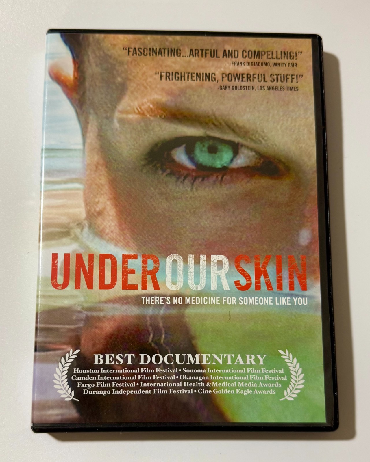 Under Our Skin – (DVD) Lyme Disease Documentary Diagnosis, Treatment VERY GOOD