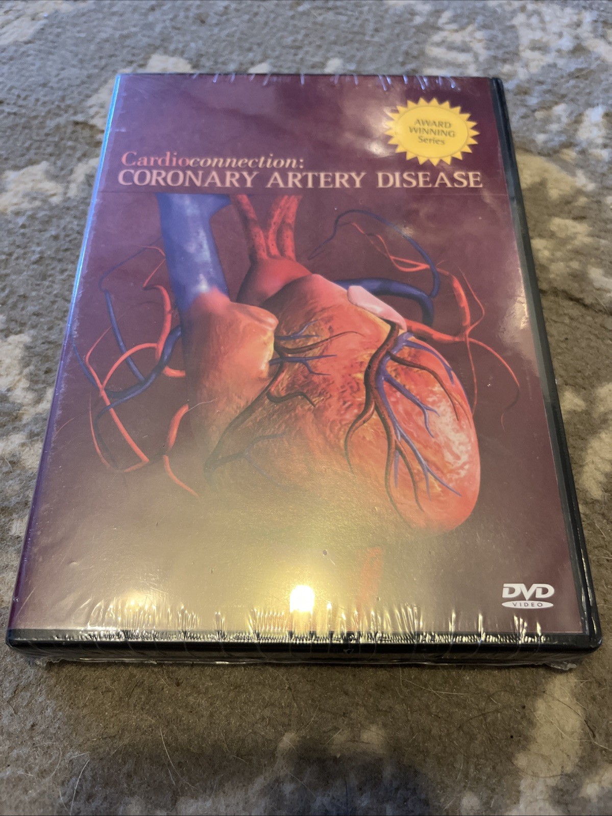 Cardio Connections 2 DVD Bundle New Sealed Heart Failure Coronary Artery Disease